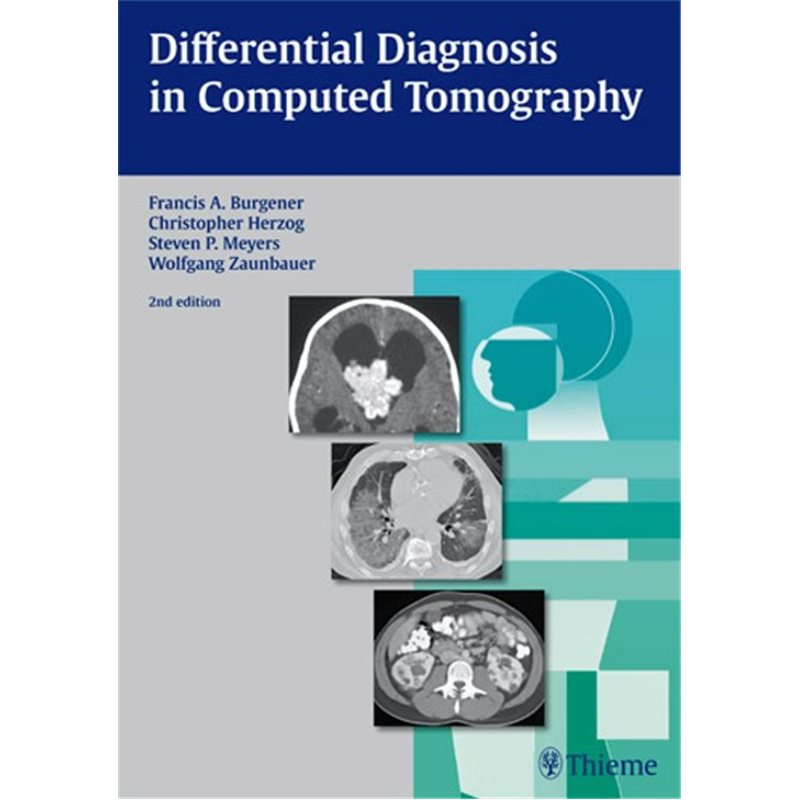 Differential Diagnosis in Computed Tomography